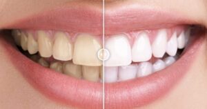 Before & After Images Comparison WordPress Plugin 1.0.1 | PlugCart